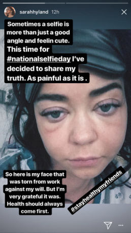 Moderni perhe Sarah Hyland on ollut sairaalassa ja jakaa turvonneiden kasvojensa tuskalliseen selfieyn